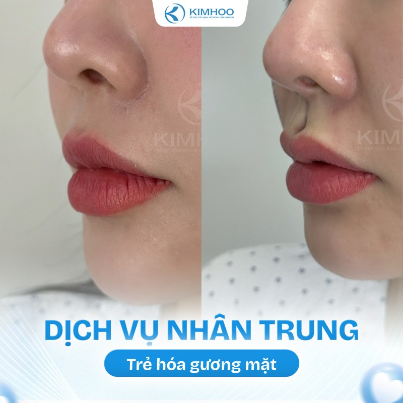 Kết quả 8 – Nhân Trung