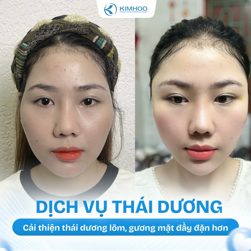 Kết quả 7 – Độn Thái Dương