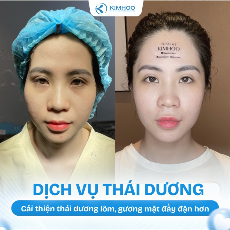 Kết quả 4 – Độn Thái Dương