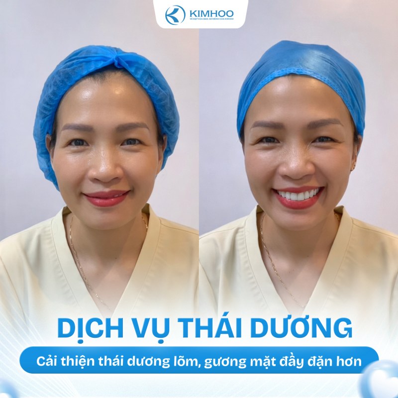 Kết quả 10 – Độn Thái Dương