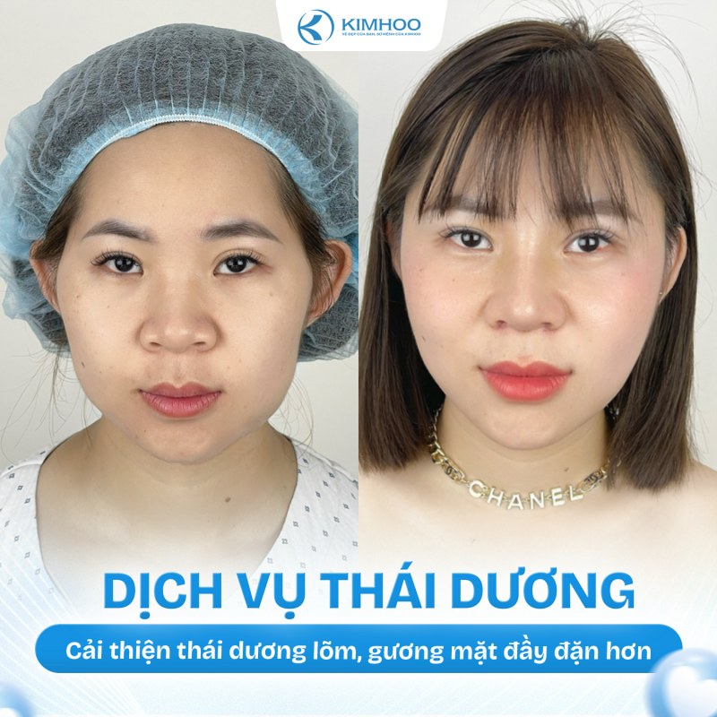 Kết quả 3 – Độn Thái Dương