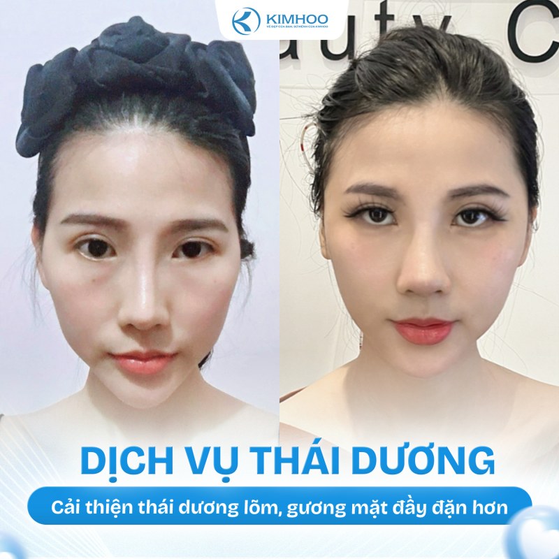 Kết quả 2 – Độn Thái Dương