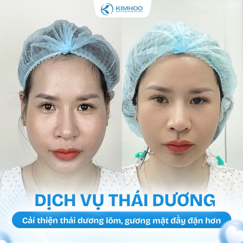 Kết quả 9 – Độn Thái Dương