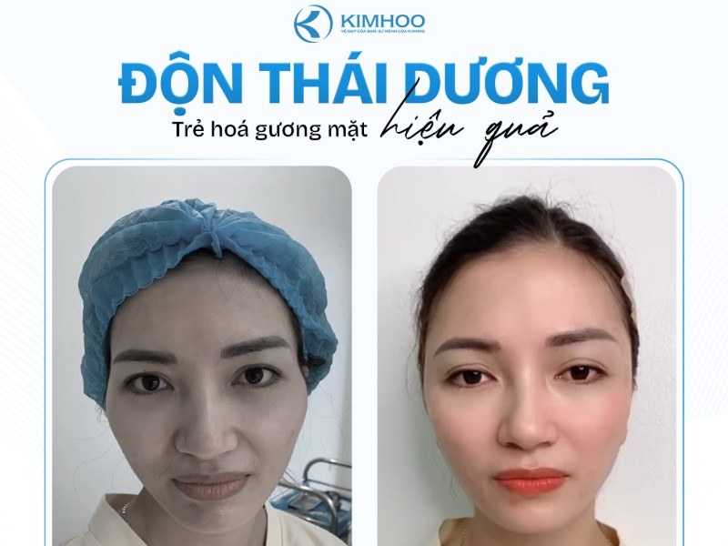 Độn Thái Dương